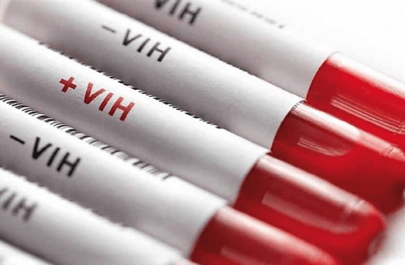 ¿El VIH produce SIDA?