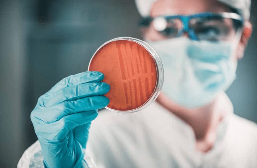 Automatización de la Bacteriología clínica