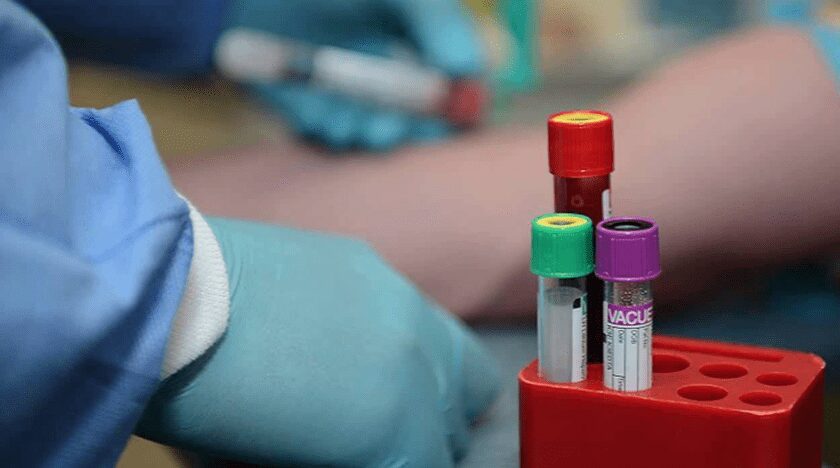 Muestras de sangre para análisis de sepsis