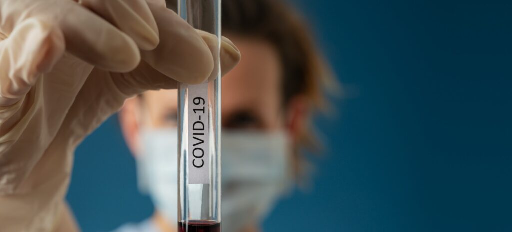 Blood sample for Covid 19