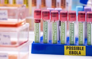 Sample vials of blood from possible Ebola patients infected with new Zaire strain of Ebola