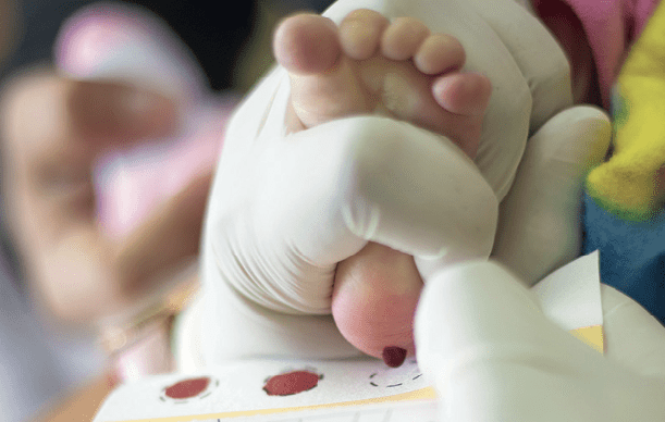 Atrofia muscular espeina